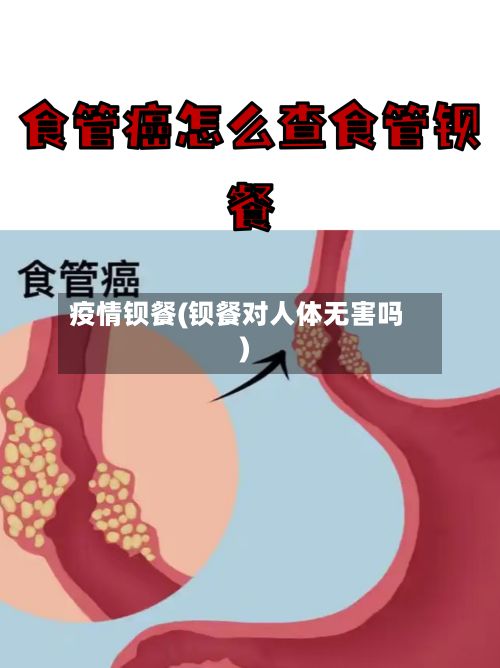 疫情钡餐(钡餐对人体无害吗)-第3张图片