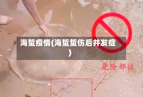 海蜇疫情(海蜇蜇伤后并发症)-第3张图片