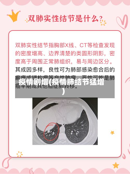 疫情剧增(疫情肺结节猛增)-第2张图片