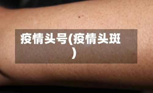 疫情头号(疫情头斑)-第3张图片